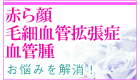 ԂEэ׌ǊgǁEǎiVr[j